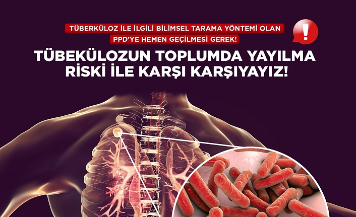 Kıbrıs Türk Tabipleri Birliği: “Verem taramasında PPD testi şart"