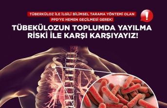 Kıbrıs Türk Tabipleri Birliği: “Verem taramasında PPD testi şart"