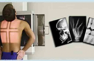 Diplomasız röntgenci