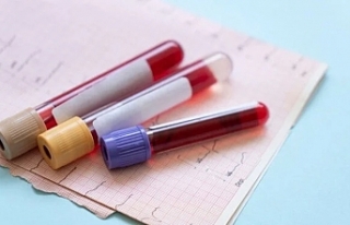 Erken tanıda devrim